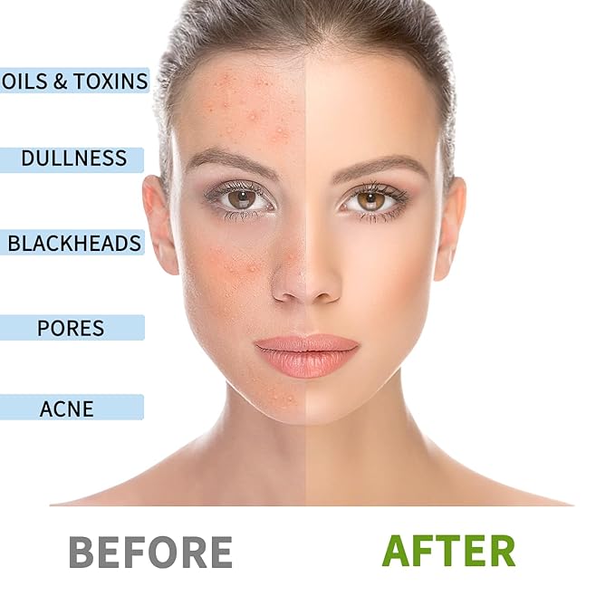 Bentonite Clay Mask, Valentines Gifts for Women Her, Deep Cleansing Facial Mask, Clay Face Mask Skin Care with Kaolin Clay and Aloe for Dull Skins Hydrating (white)