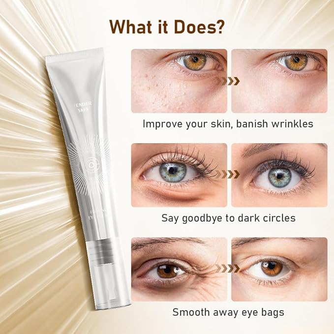 Niacinamide Eye Cream for Dark Circles & Puffiness – Hydrating Under Eye Treatment for Fine Lines & Wrinkles – Firming & Anti-Aging – Sensitive Skin Safe, Fragrance-Free