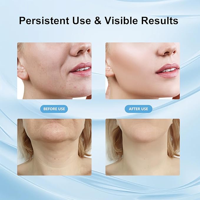 Facial Massager for Face and Neck, Red-Light-Therapy and Vibration Technologies (White)