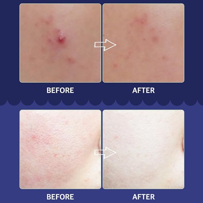 CRAZY SKIN Skin Repair Trouble Care Overnight Sleeping Face Mask 1.76oz | Overnight Facial Cream | Moisturizer for Acne-Prone Skin | Pore Minimizer Cream Mask with Eggplant Extract, Salicylic acid