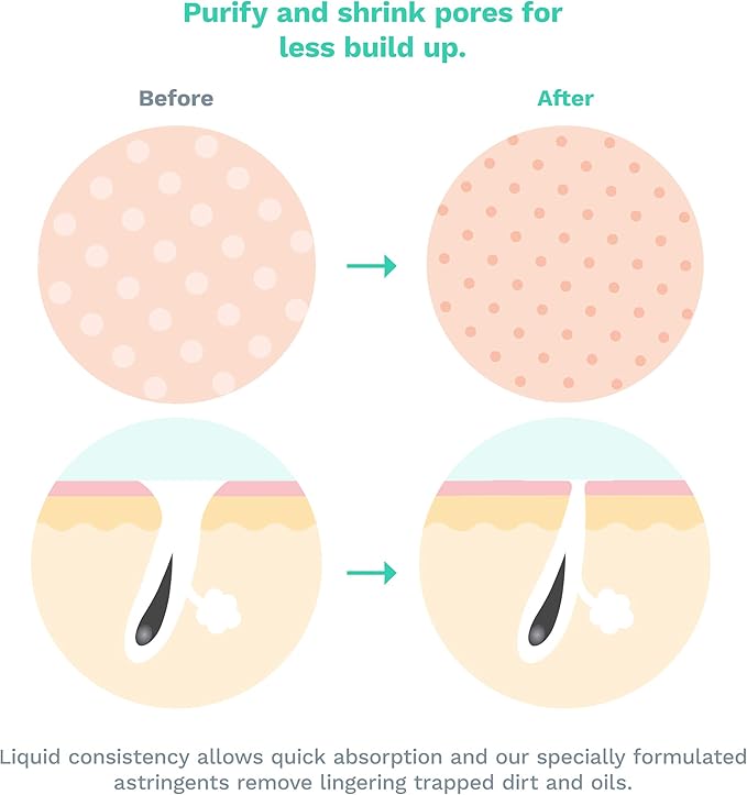 Purifying Toner for Face & Skin – Pore Minimizer Facial Astringent Acne Treatment for Women & Men – Witch Hazel, Lavender, Sage & Hops Combination for All Skin Including Dry, Oily and Sensitive