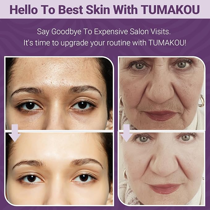 RF Radio Frequency Facial Device - LED Red Light Therapy Device for Face Skin Care Home Use