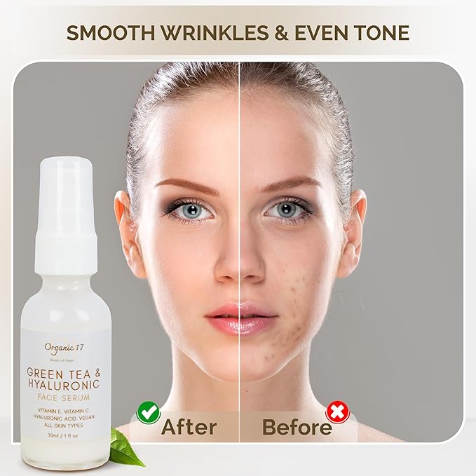 Hyaluronic Acid & Green Tea Face Serum – Anti-Aging Hydrating Serum with Vitamins C + E for Glowing Skin, Vegan & Cruelty-Free for All Skin Types – 30ml