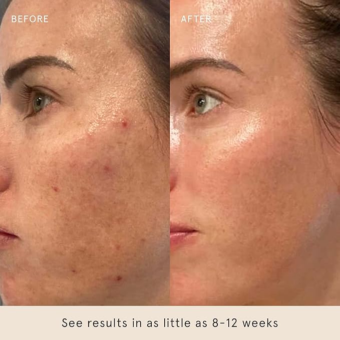 Barefaced Retinal Skin Therapy 30ml - Retinaldehyde & Bakuchiol Serum for Firming, Reducing Fine Lines & Wrinkles, Improving Skin Tone & Texture w/ Shea Butter, Jojoba Oil & Argan Oil