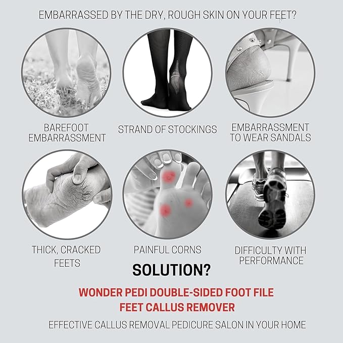 Made in Germany Ceramic Stone and Stainless Steel Foot File, Double Sided Callus Remover, Feet Scrubber, Professional Pedicure Foot Care Tool Rasp, Long Lasting Foot Buffer, Heel Scraper, Wonder Pedi