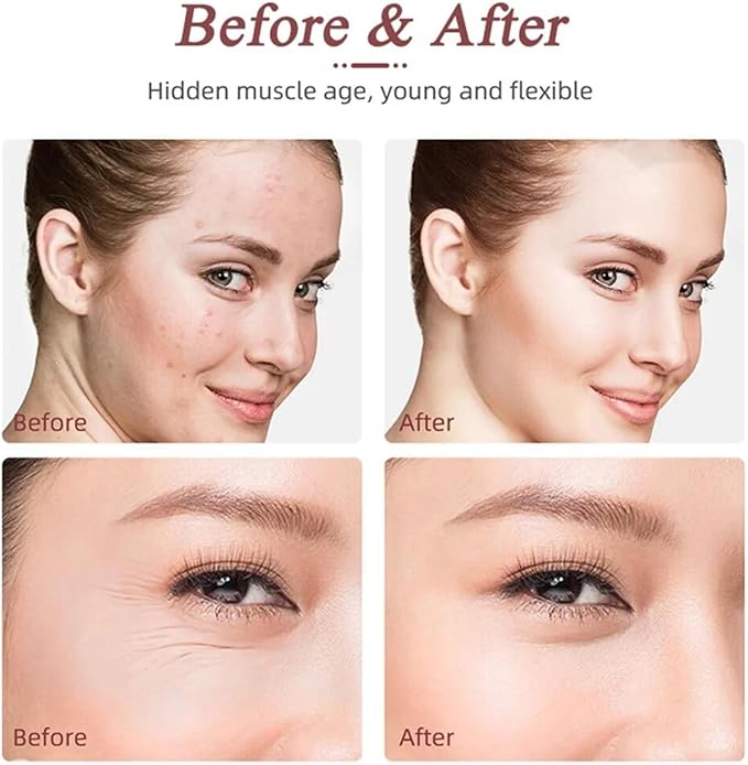 Skin Tightening Machine for Face - Anti-Aging Wrinkle Reduction for Facial Neck Lifting, Firming, Massaging and Toning Home Use 3 in 1 Upgraded Version