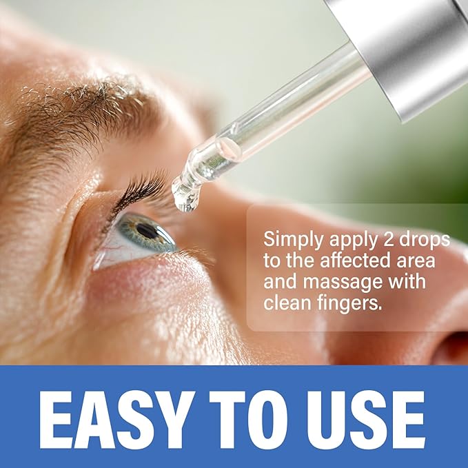 ITECFREELY Stye Eye Treatment, Natural Stye Eye Relief Drops Serum for Styes Chalazion and Blepharitis, Fast Chalazion Remover for Restore Healthier Skin-1 Fl.oz