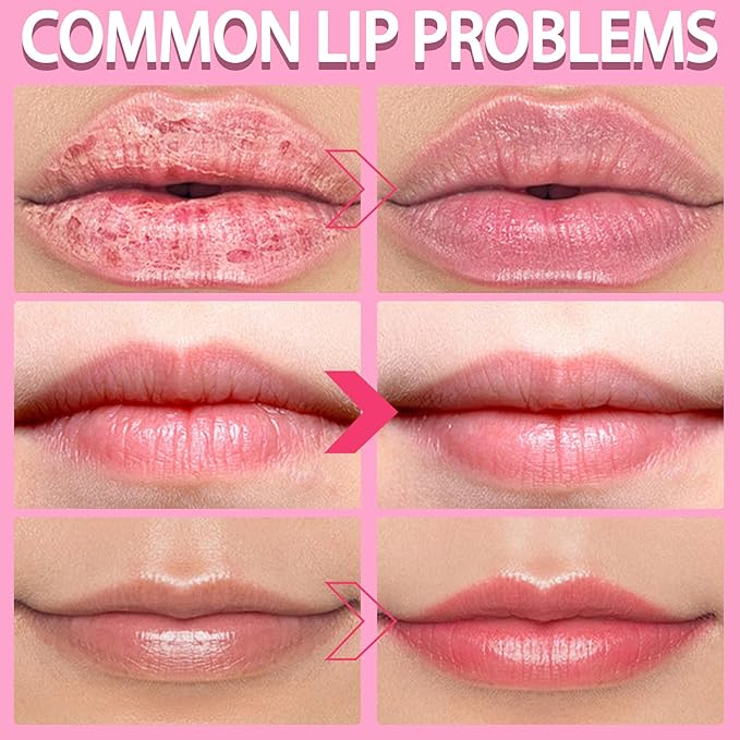 2PCS Lip Scrub Exfoliator,Gentle Lip Scrubber Exfoliator,Lip Exfoliator Scrub for Daily Lip Care,Lip Moisturizer for Nourishing Lip(Peach, Avocado)