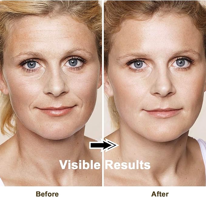 Lefay Face Skin Tightening Machine - Radio Frequency Anti-Aging Device Microcurrent Face Massager Lifting, Firming, Toning, Wrinkles Reduction De-Puffiness for Facial and Neck