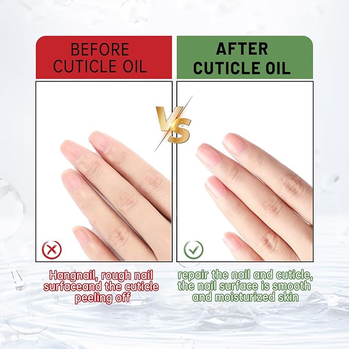 Cuticle Oil for Nails Organic Nail and Cuticle Oil Nail Oil Treatment for Damaged Nails Cuticle Repair 0.7oz 2Pack