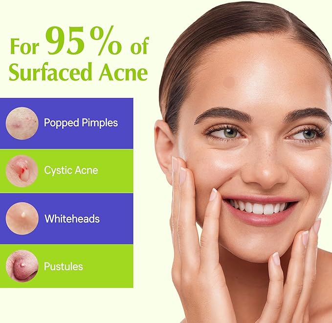 Pimple Patches for Face, Invisible Hydrocolloid Acne Patches Acne Treatment,Covering Zits & Blemishes in Skin and Face, Zit Patches with Salicylic Acid, FSA HSA Store Eligible Items 120 Count