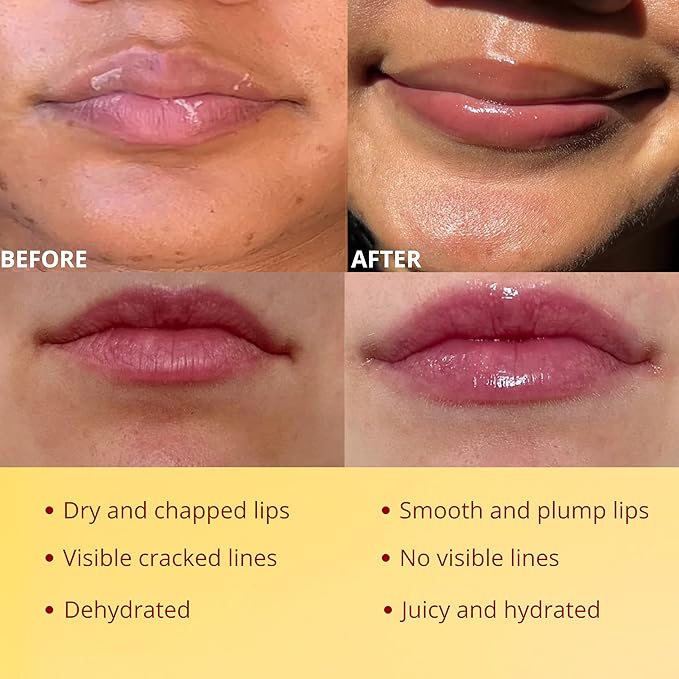 3 Pcs Original My Bee Balm Lip Balm β Hydrating Lip Care with Watermelon, Strawberry & Honey Pot β Moisturizing Balm for Dry, Chapped & Cracked Lips with Propolis, Honey & Vitamin E