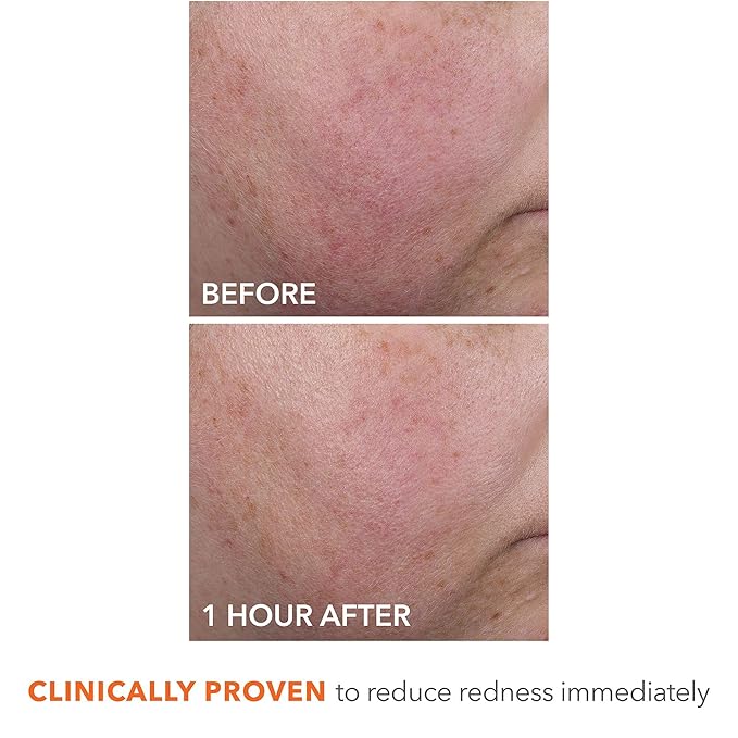 Dr Dennis Gross DermInfusions Blur + Repair Cream, Instantly Blurs Fine Lines, Smooths Skin with Satin-Matte Finish, Visibly Plumps & Firms, Reduces Redness, & Improves Skin Elasticity, 0.67 Fl Oz