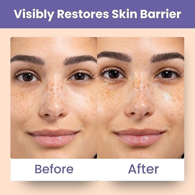 Patchology Skin Remedy Barrier-Boosting Sheet Mask - Single