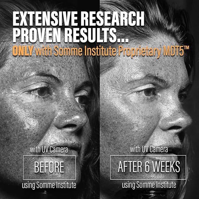 Pore Minimizer Face Mask | Detoxifying, Anti-Aging Clay Mask | Acne Face Mask | Natural Skincare | Deep Hydration