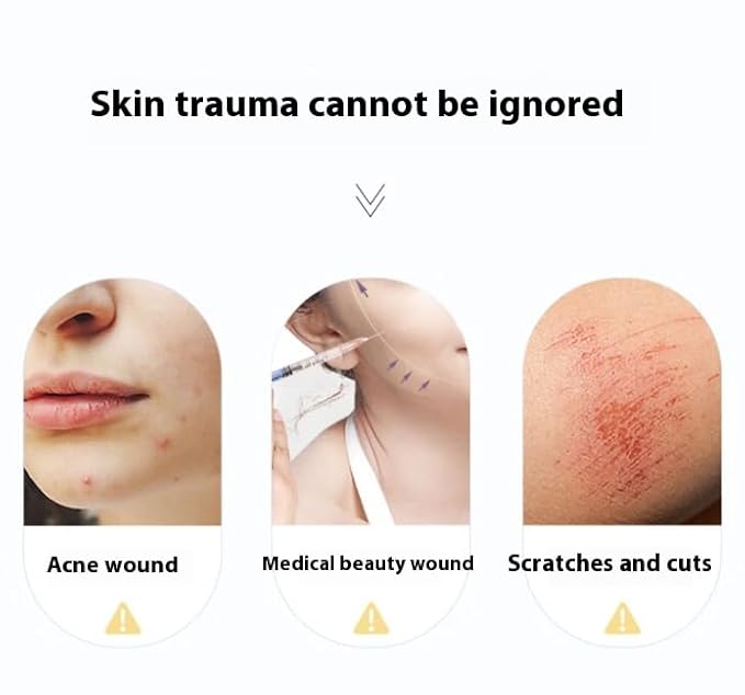 Voolga Collagen Booster Patch Hydrating Hydrogel Face Mask Easy To Use Repair, Moisturize And Heal Wounds 敷尔佳重组III型人源化胶原蛋白贴 26g/5 Pieces/Box