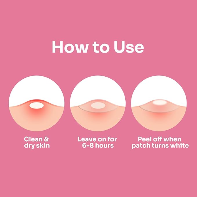 Conkote Acne Patches for Face, Large Pimple Patches to Absorb Acne Gunk from T-Zone, Cheeks, and Chin, Invisible Spot Treatment for Breakouts and Blemishese, 5 Count