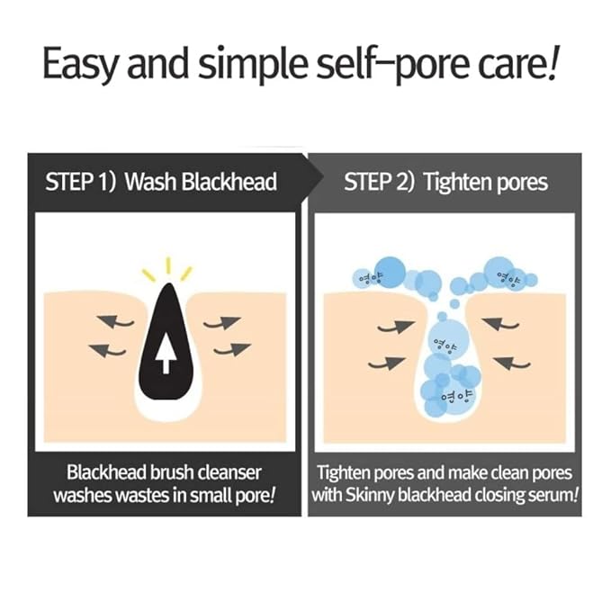 RiRe Women's Skinny Blackhead Closing Serum, 1.35 Ounce