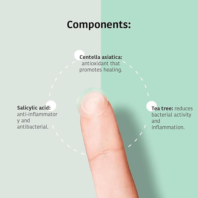 Pimple Patches (90 patches) + Facial Charcoal Masks (5 Masks) - Salicylic Acid Pimple Buttons & Face Mask for Skin Care with Activated Charcoal, for acne-prone skin, Vegan - Total Bundle 10 pieces