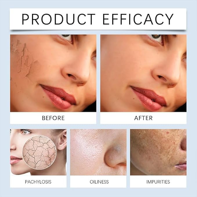 Hyaluronic Acid Powder, Hyaluronic Acid Powder for Skincare, Low Molecular Weight, Water Soluble Hydrating Ingredient for Moisture,Skin Hydration and Moisture Support(100g/3.52oz)