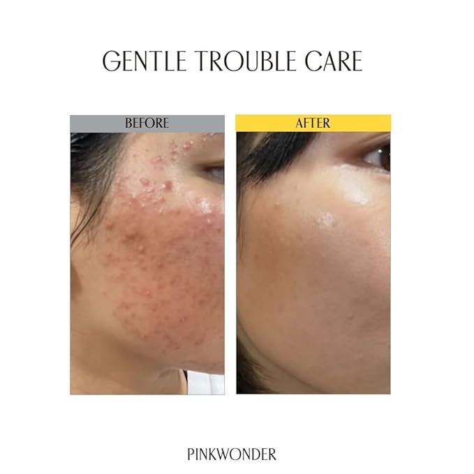 Tamanu Hero Ampoule⁺ 1.69oz (50ml), 50,000ppm Tamanu Oil for Soothing