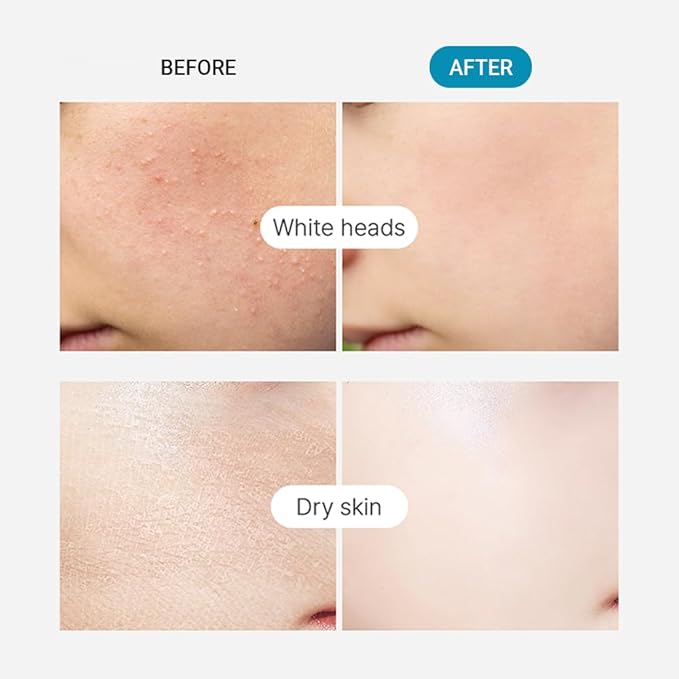 TENZERO Moisture Collagen Toner Pad 70ea, 100% Natural Cotton, Hydrating Moisturizing Glowing Face Toner Pads, Korean Facial Toner, Dry Skin, 160g