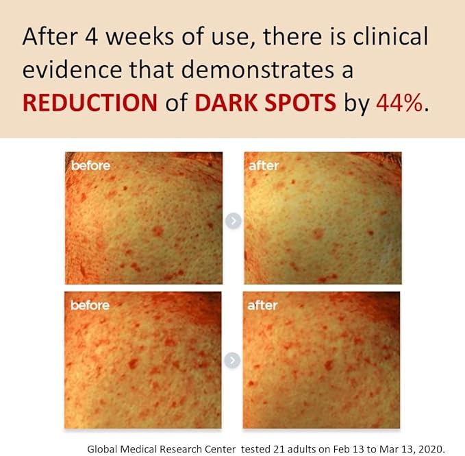 [Make p:rem] Poncirus trifoliata C Dark spot serum | Skin clearing serum | Uneven Skin Tone Treatment | Vitamin serum C face | 40ml, 1.35 fl.oz. | Make P:REM