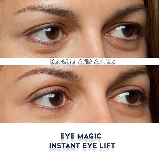 Premium Eye Lift (S/M Strips) Made in America. Instantly Lifts and Defines Droopy, Sagging or Hooded Eyes Safe for Daily Use
