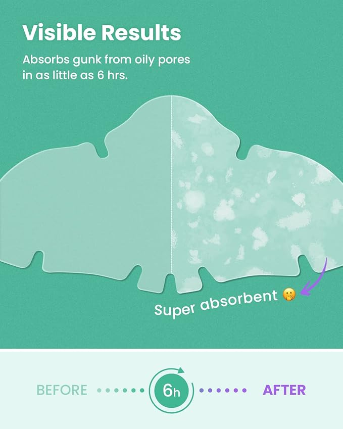 GLAM UP Spotless Nose Patch Hydrocolloid Coverage for Nose Pores, Zits and Oil - Overnight Strong Waterproof to Absorb Blackheads & Pimple Nose Gunk, and Calm with Tea Tree (12 Patches)