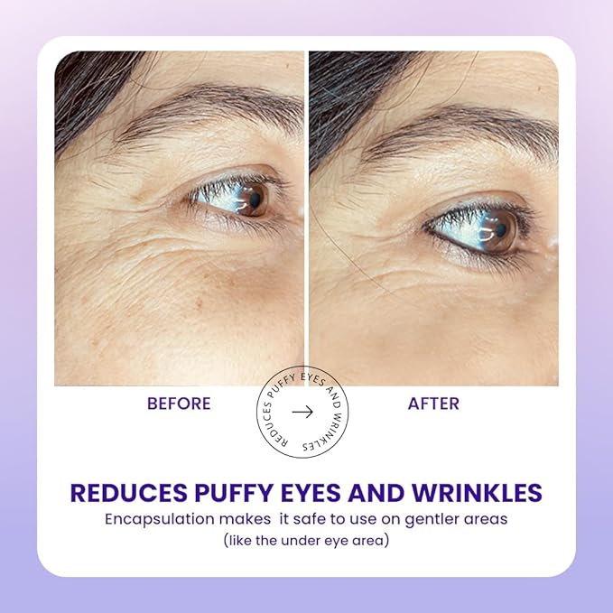 TRUTH & BEAUTY Intermediate Smart Ageing Complex Serum 0.1% Retinol, 0.5% Bakuchiol & Ginseng Extract for Fine Lines, Wrinkles Hydration Face Serum for All Skin Types (1.01 Fl OZ) Smart Ageing