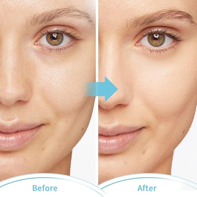 Cold Face Eye Masks Ice Face Mask Hot Cold Compress For Dark Circles, Puffiness, Migraines, Headache, Stress, Redness, Cooling Face Masks For Women Man, Skin Care