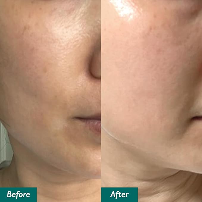 Edelweiss Lifting Serum – Anti-Aging Formula with Edelweiss Extract, Niacinamide, Peptides for Firming, Hydration & Brightening – 1.35 fl.oz