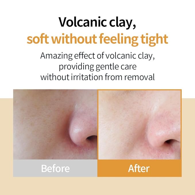 Volcanic Clay Blackhead Removal Mask for Oily Skin - Pore Tightening, Sebum Control, Skin Soothing K-Beauty Face Mask, 4.23oz
