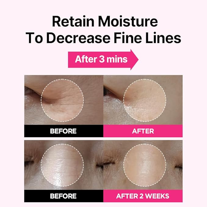 ISOI Blemish Care Up Serum Triple Set, Korean Skin Care for Glass Skin Radiance, Includes 2 Full Size & 1 Refill Serums, Eye & Wrinkle Patch Tester, Daily Hydration Gift Set (2.13 fl. oz)