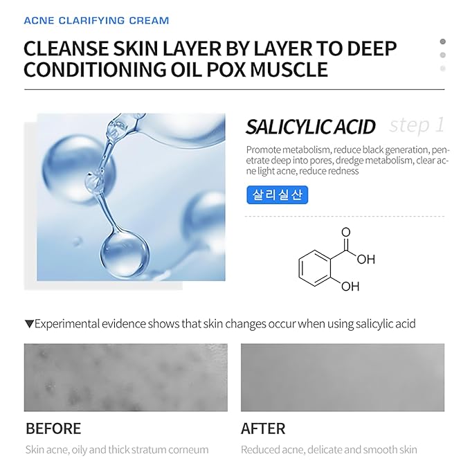 DEleventh Korean Brand Acne Clarifying Cream 30g / with Salicylic Acid, Vitamin B5, and Soothing Botanicals for a Clear, Nourished Complexion, Anti-Acne, Combats Blemishes, Hydrates, and Revitalizes