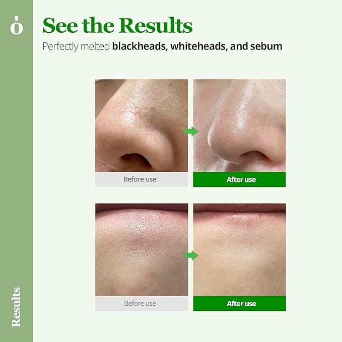 ONGREDIENTS Perfect Melting Cleansing Balm | Non-Greasy Cleansing Oil | Panthenol, Heartleaf, Makeup, Sunscreen Remover, Soothing for All Skin Types | Vegan, Korean Skin Care 100ml / 3.38 fl Oz