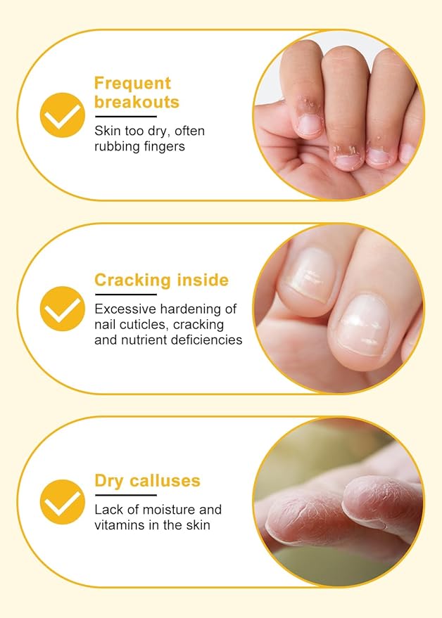 EJW Cuticle Oil for Nails, Rose and Milk Honey, Improves Hangnails and Hand Lines, Contains Vitamin E and Jojoba Oil, Natural Ingredients