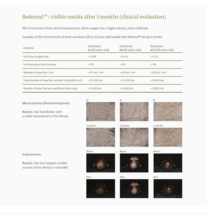 Vitamin Mask - Promotes Natural Hair Growth, Vegan, Anti-Aging, Color & Keratin Safe, Hydrates & Strengthens with Redensyl, Designed for All Hair Types, 6 oz