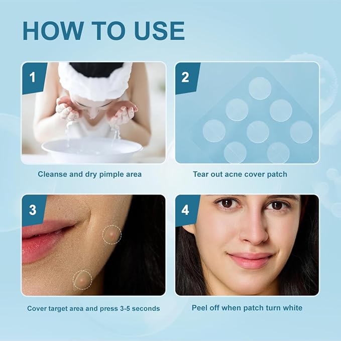 Pimple Patches for Face, Hydrocolloid Acne Patches, Absorb Zits and Blemishes, Invisible Spot Cover, Treatment for Breakouts, Acne Stickers with Salicylic Acid and Tea Tree Oil (36 Count)