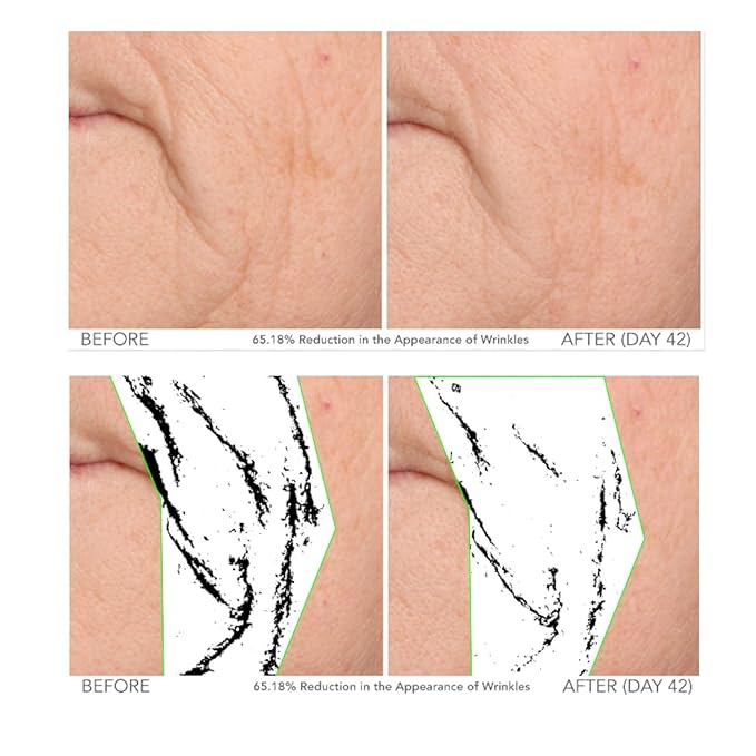 Serious Skincare - Beyond Intensive Vitamin C Serum for Face & Neck - 60 Day Facial Treatment to Brighten & Revive Glow - Visibly Smooth Lines, Wrinkles and Pores - AM & PM 2 Piece Skin Care Set