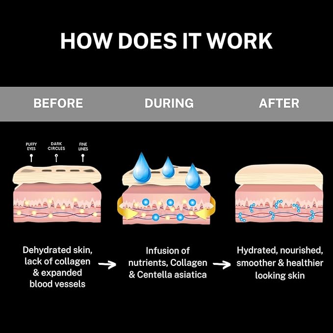 CÉLOR Under Eye Patches for Puffy Eyes and Dark Circles (64 Pairs) with Amino Acid & Collagen - Under Eye Masks Great for Bachelorette Party Favors, Swag Bag Stuffers, Spa Gifts for Women