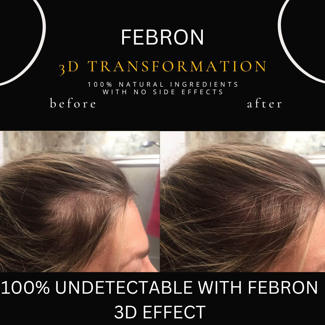 FEBRON Hair Fibers For Thinning Hair MEDIUM BROWN Giant 30G For Women & Men Hair Loss Concealer Hair Powder Volumizing Based 100% Undetectable & Natural - Bold Spots Filler