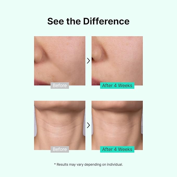 TIAM Vita A Bakuchiol Youth Serum, 1.35 fl oz, Anti-Aging Serum for Wrinkles & Dark Spots, Enhances Firmness & Elasticity, Retinol Alternative for Sensitive Skin, Korean Skin Care