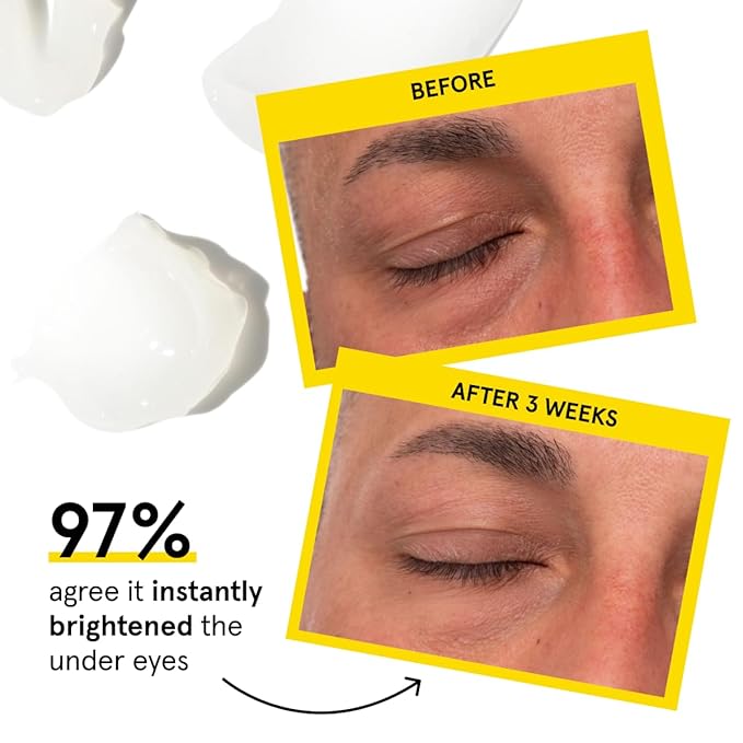 Lumin - Men's Dark Circle Defense Balm - Anti-Aging Korean Formulated Eye Cream Treatment for dark circles, fine lines, & wrinkles, Suitable for all skin types, Daily Use, 20ml, 1-Pack