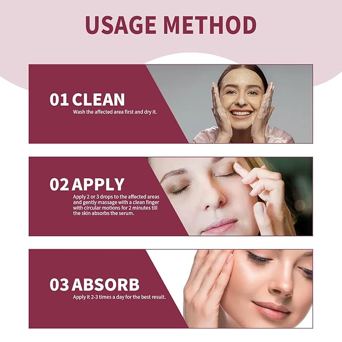 Stye Eye Treatment, Chalazion Remover, Gently Cleanses Lashes and Eyes, Restore Healthier Eye Skin