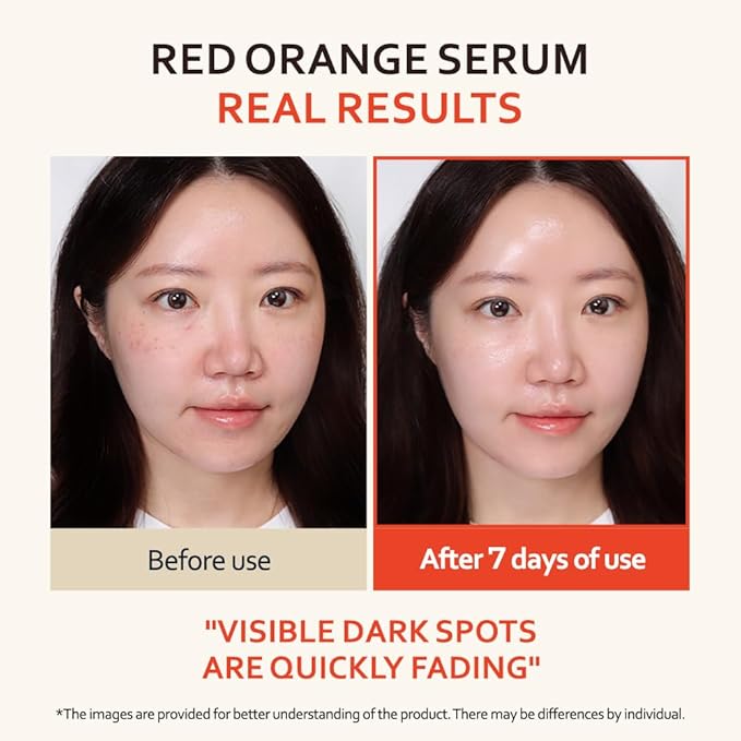 T'else Red Orange Niacinamide Serum 30ml, 1.05 Fl.oz, Blemish and Skin Flaws Improvement, Moisturizing Gel Formula Lotion, Rich Vitamin & Panthenol Facial Care, Smooth Skin Texture, Korean Skin Care