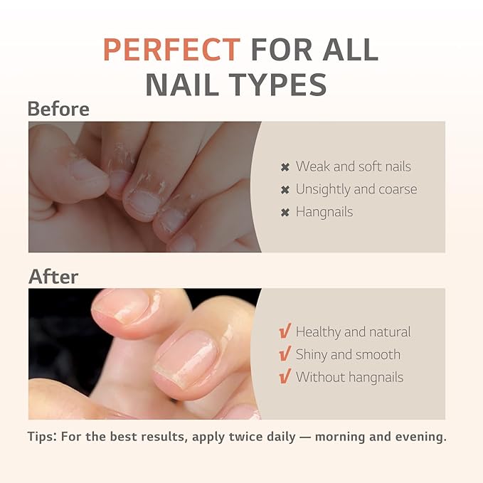 Aokitec Natural Cuticle Oil - Milk & Honey Flavor Cuticle Oil for Nail Growth and Strengthener with Vitamin E Repair Damaged Skin and Thin Nails Moisturizes Cuticle & Overnight Cuticle Softene