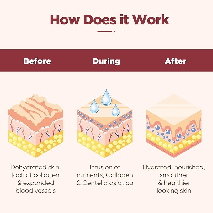 Under Eye Patches (20 Pairs), pink Hyaluronic Acid Eye Patches For Puffy Eyes, Dark Circles, Puffiness, Refresh,Revitalizing, Wrinkles, Anti Aging & Face Moisturizer For Women and Men.