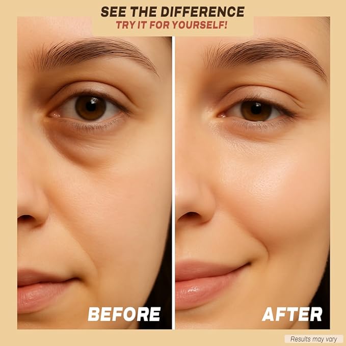 Under Eye Patches with Caffeine, Collagen & Niacinamide (30 Pairs) – Hydrating Eye Mask for Puffy Eyes, Dark Circles, Wrinkles, and Fine Lines – Reduces Eye Bags – formulated in North America