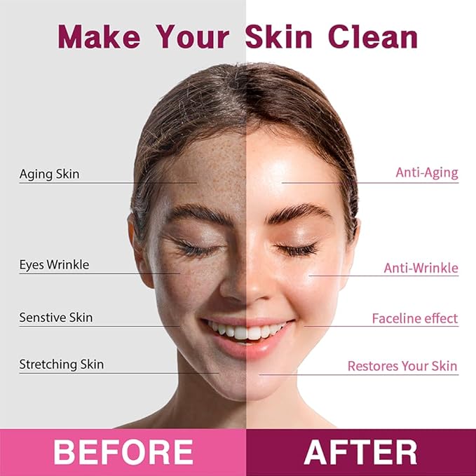 Purederm Dual Shaping Face-line Patch (5 Pack) - V Line Lifting Mask for Total Face-Line Care